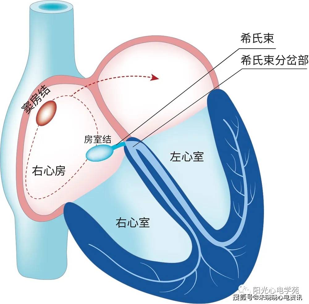 阵速心动，怎么治？