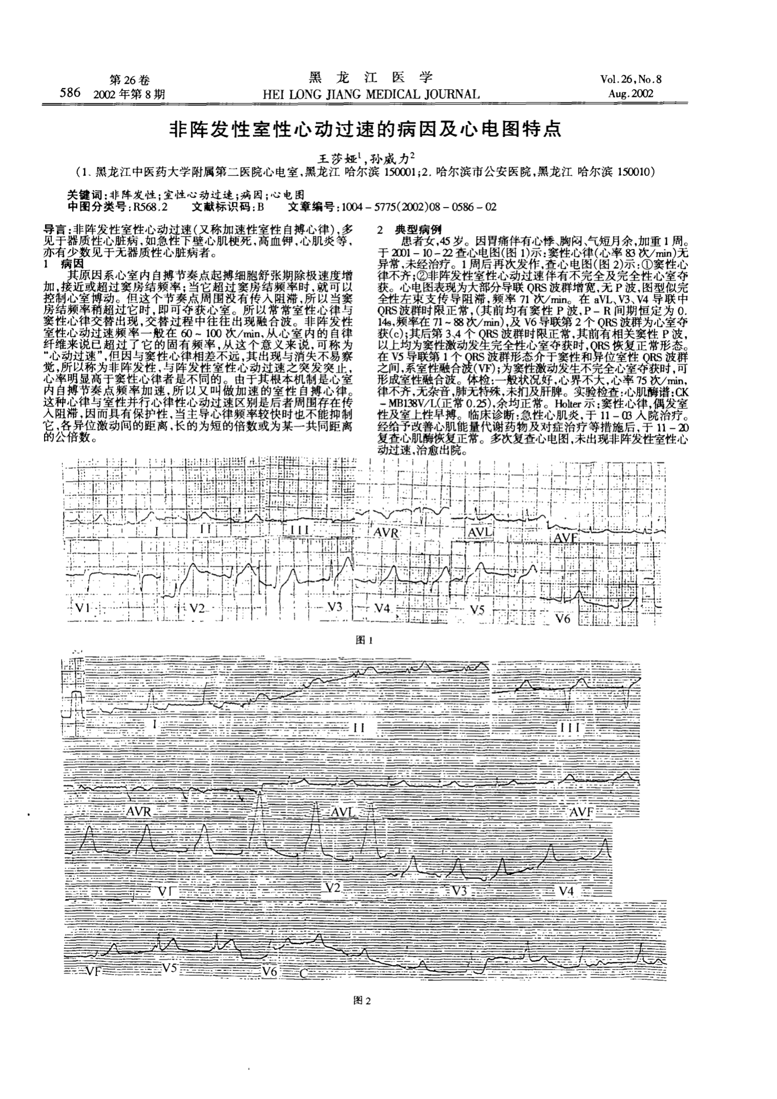 阵发性室上性心动过扑_2016上砂新闻上砂过老_尸毒过木阵