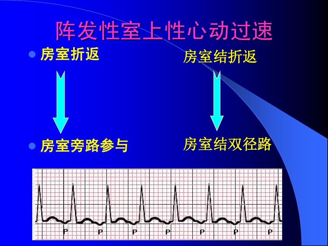 阵发性室上性心动过扑_2016上砂新闻上砂过老_尸毒过木阵