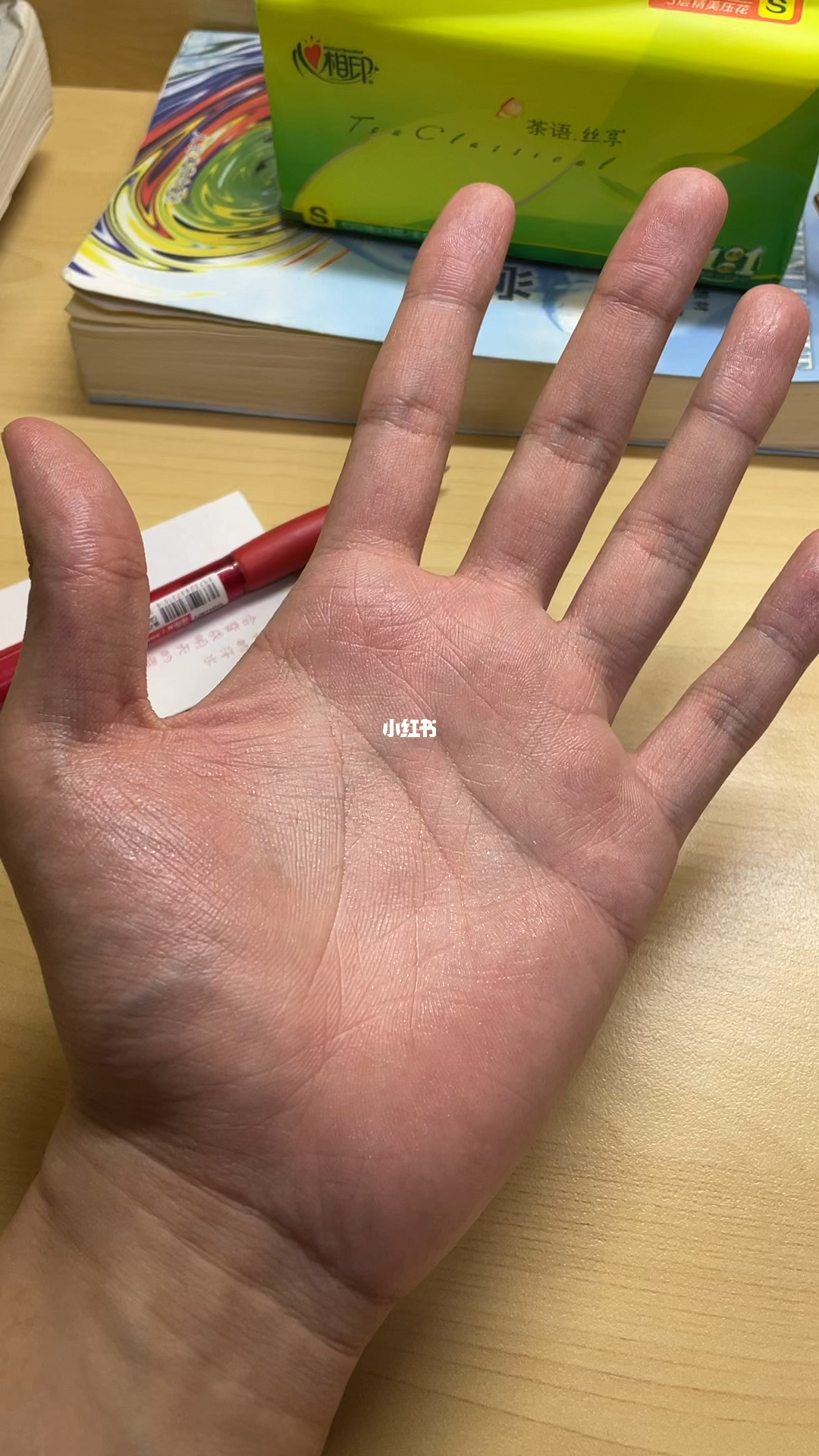 出手汗打游戏怎么办_手机打游戏手爱出汗怎么办_手出汗玩游戏操作不好怎么办