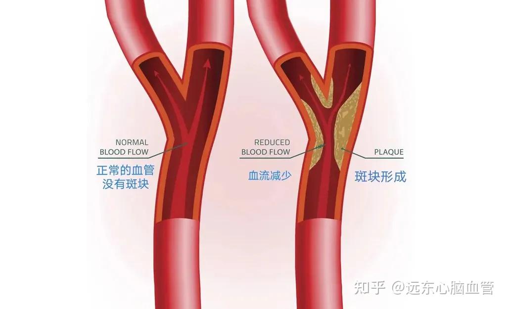 头晕打手机游戏有影响吗_手机打游戏头晕_头晕玩游戏