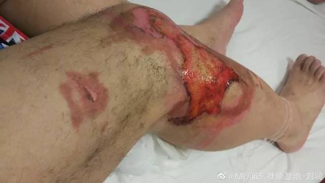 金山打字中手机版游戏_火光游戏发布网手机版_手机打游戏发烫爆炸了吗